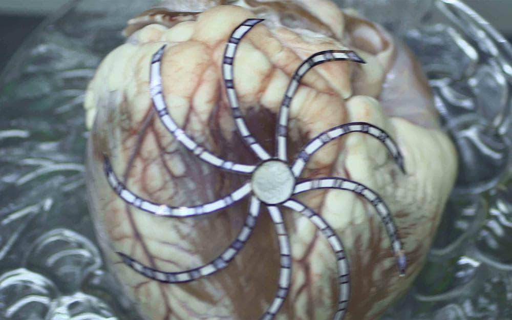 Heart rate stimulation system