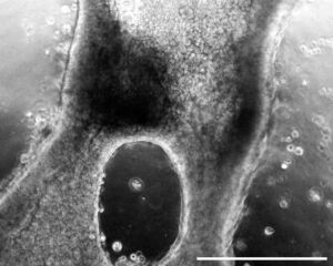 Heterogenous Lung Organoids